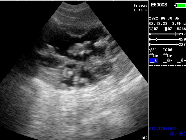 1-E5000s-05.jpg 1-E5000s-05.jpg